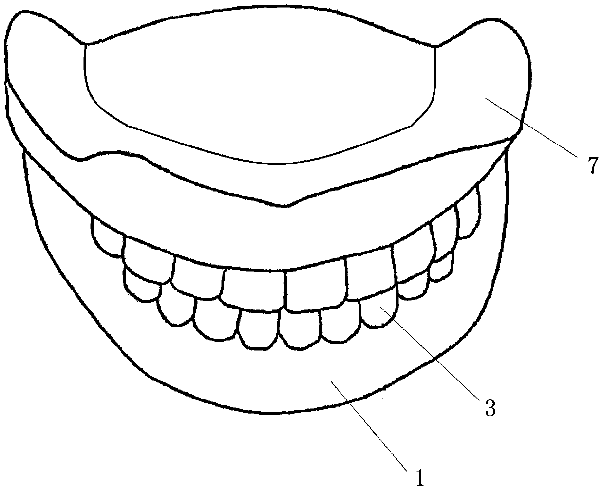 Full denture and preparation method thereof