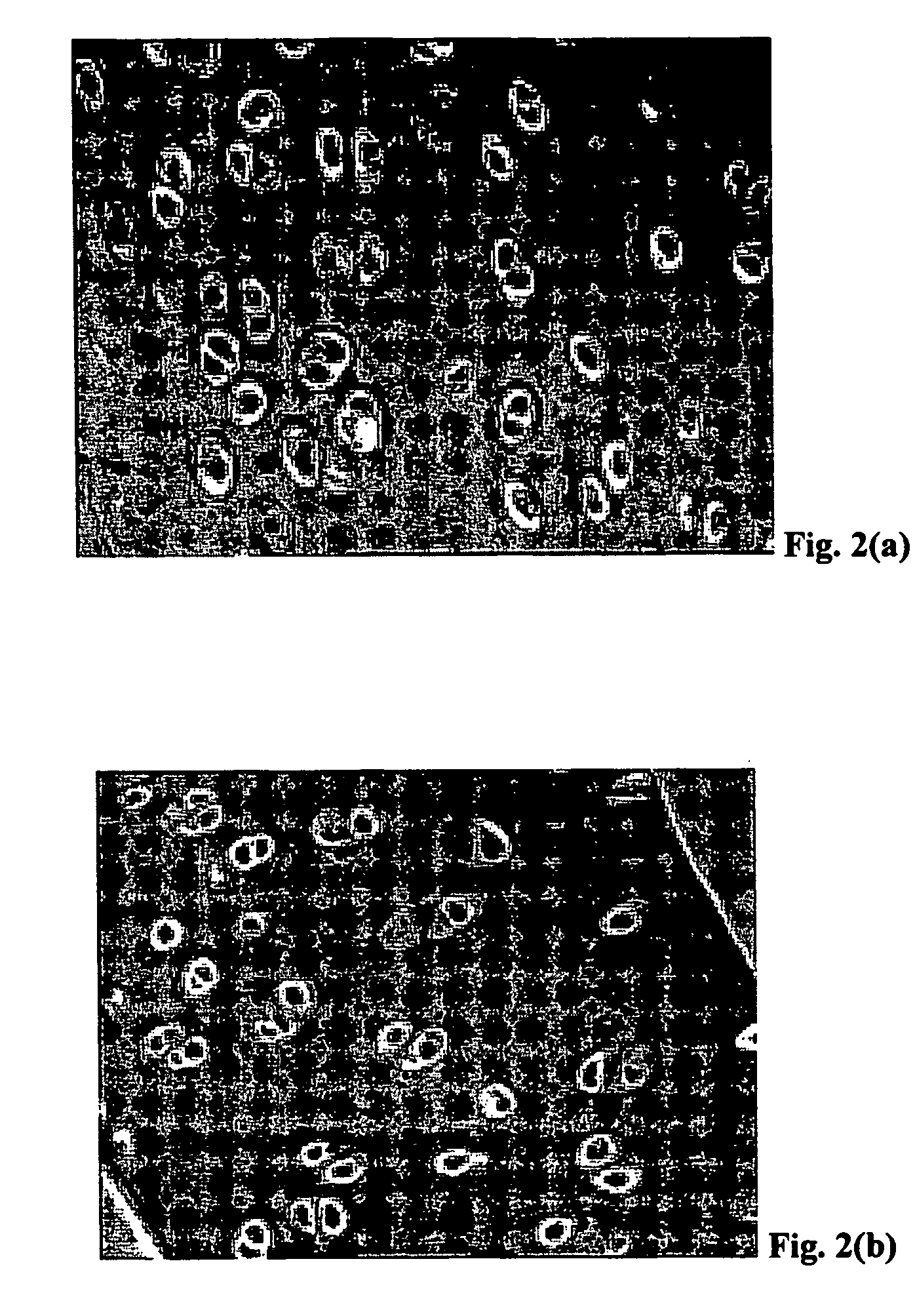 Method for freezing, thawing and transplantation of viable cartilage