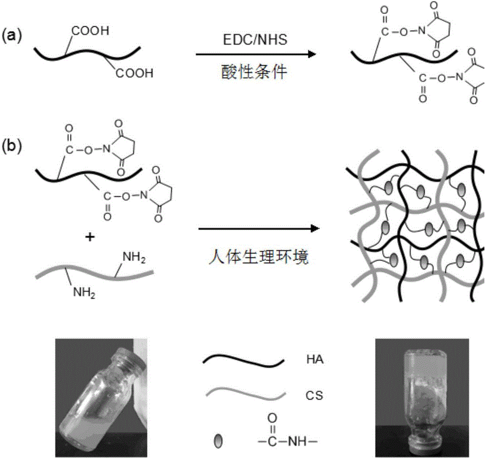 NGF (Nerve Growth Factor) injectable in-situ hydrogel as well as preparation and application thereof