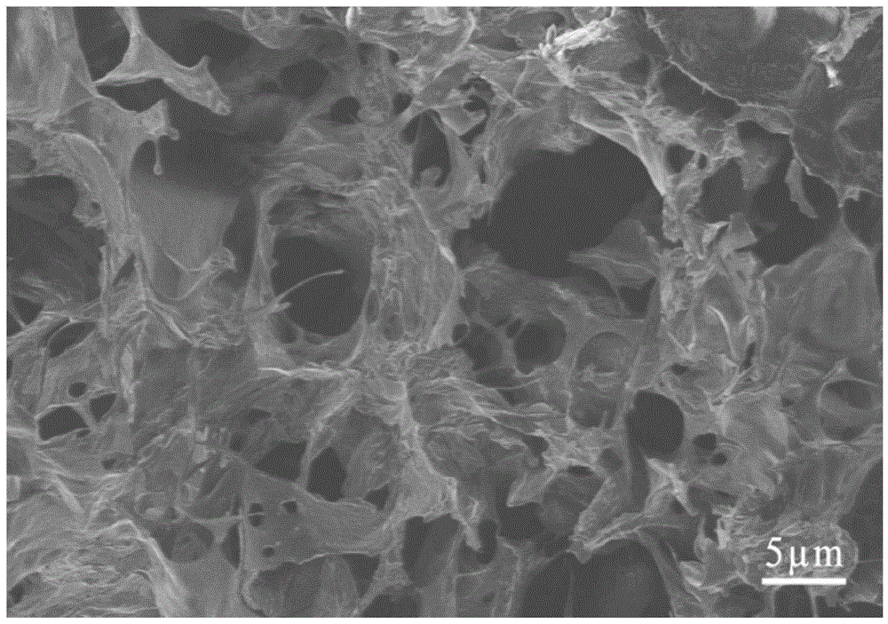 NGF (Nerve Growth Factor) injectable in-situ hydrogel as well as preparation and application thereof