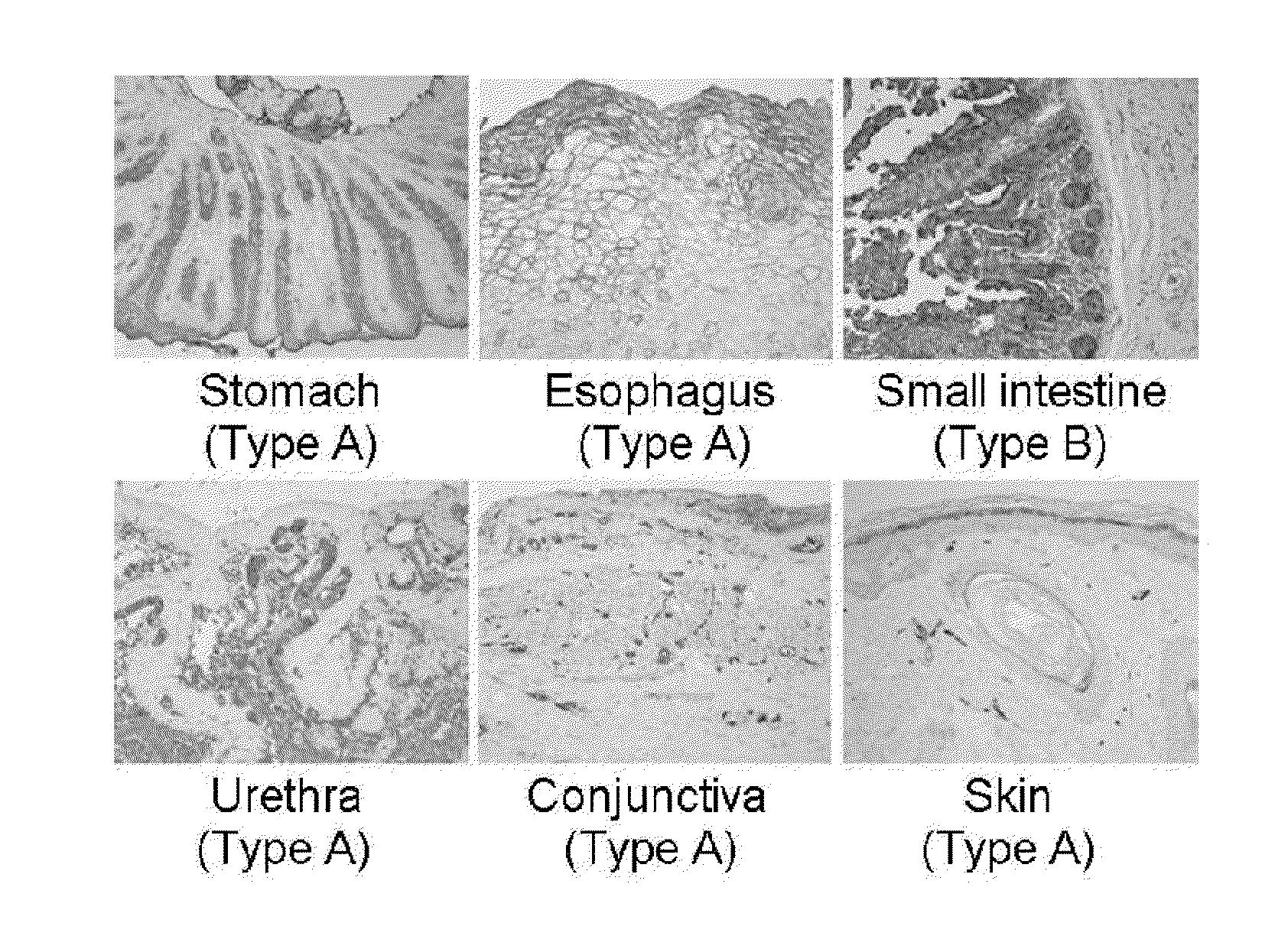 Composition for improving inflammatory disease using abh antigens