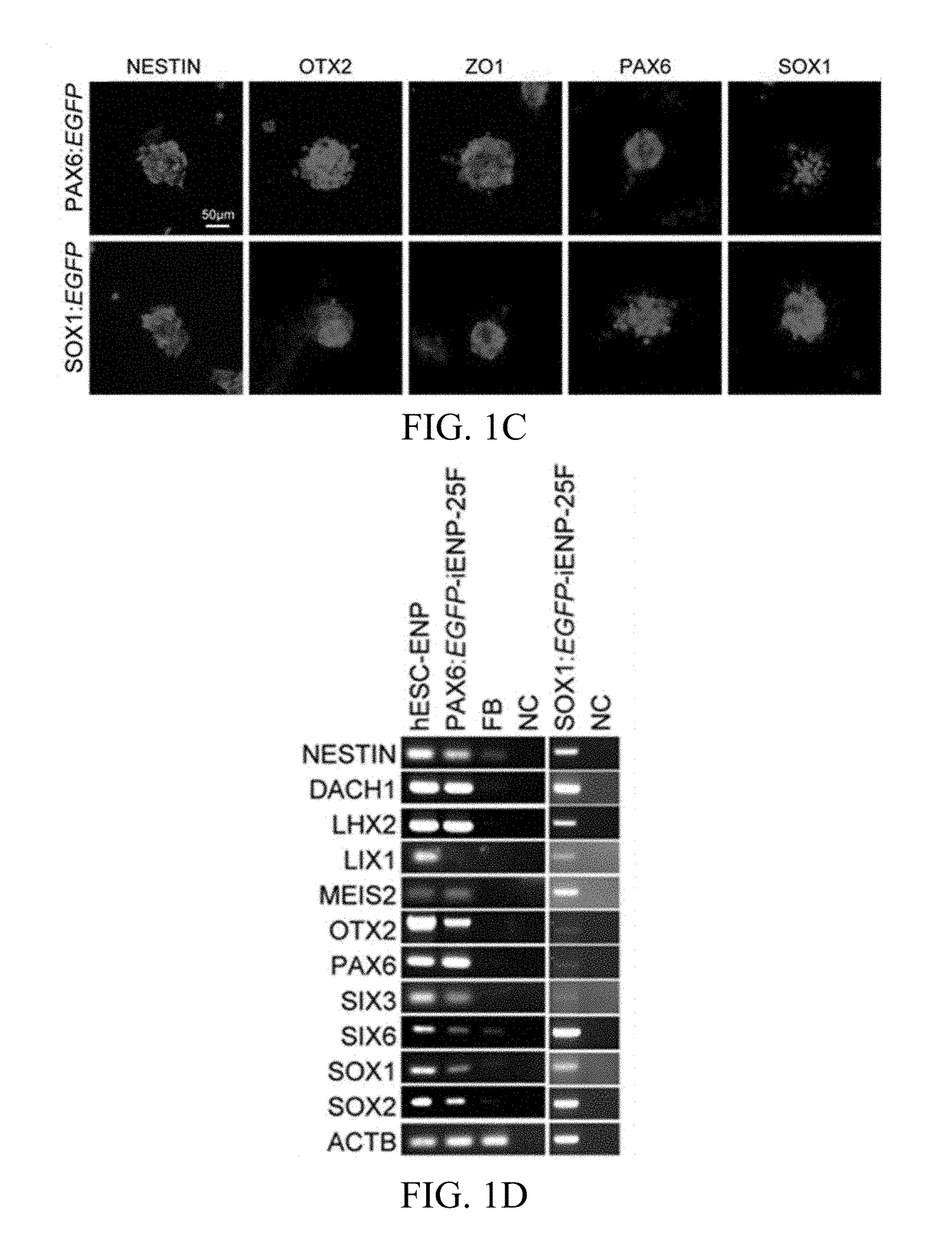 Kit for selecting neurological drug and uses thereof