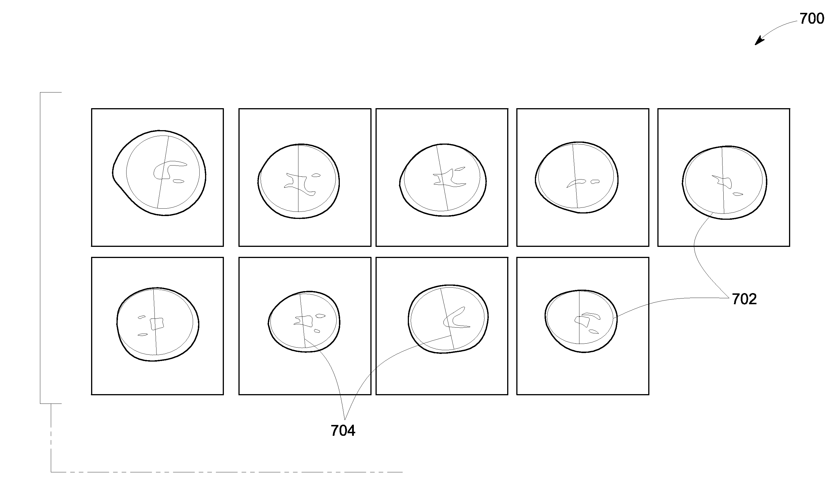 Method and system for automated detection and measurement of a target structure