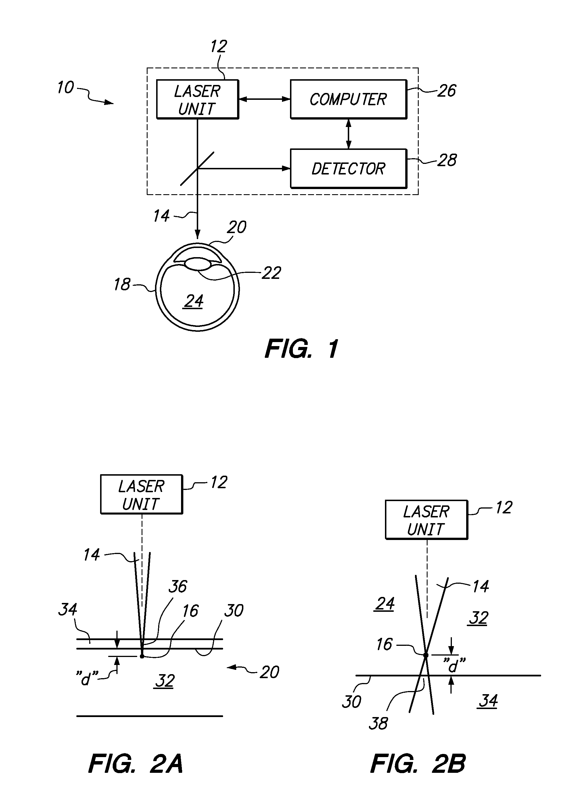 System and Method for Laser Ablation on a Surgical Surface