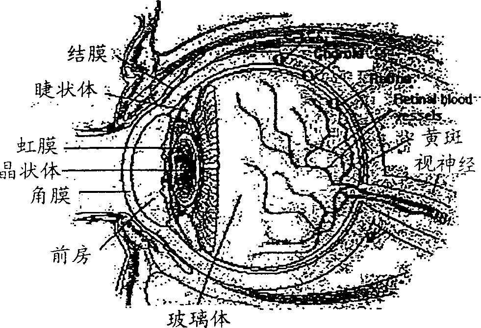 Compositions and method of administering tubulin binding agents for the treatment of ocular diseases