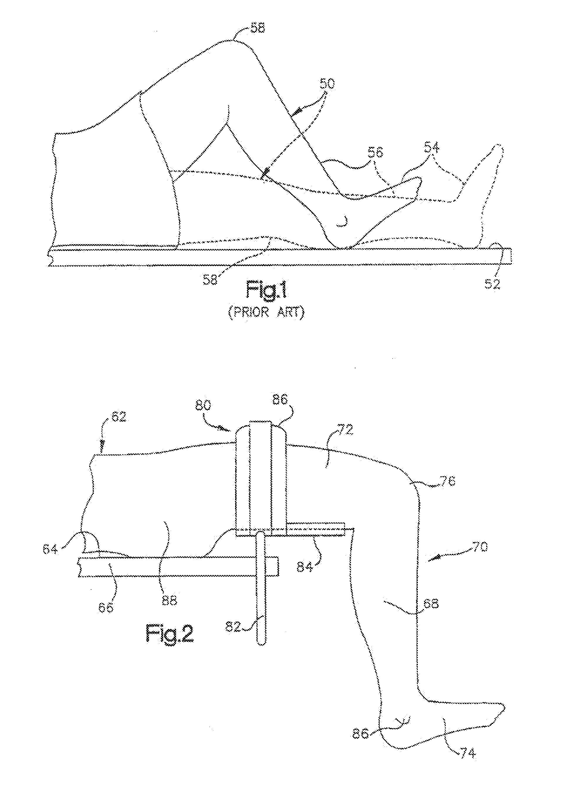 Robotic arthroplasty system including navigation