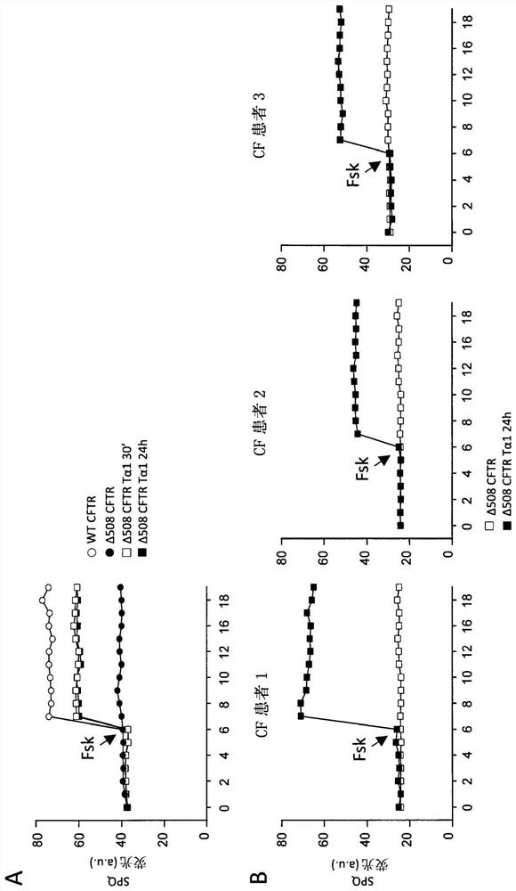 Use of thymosin alpha 1 for the treatment of cystic fibrosis