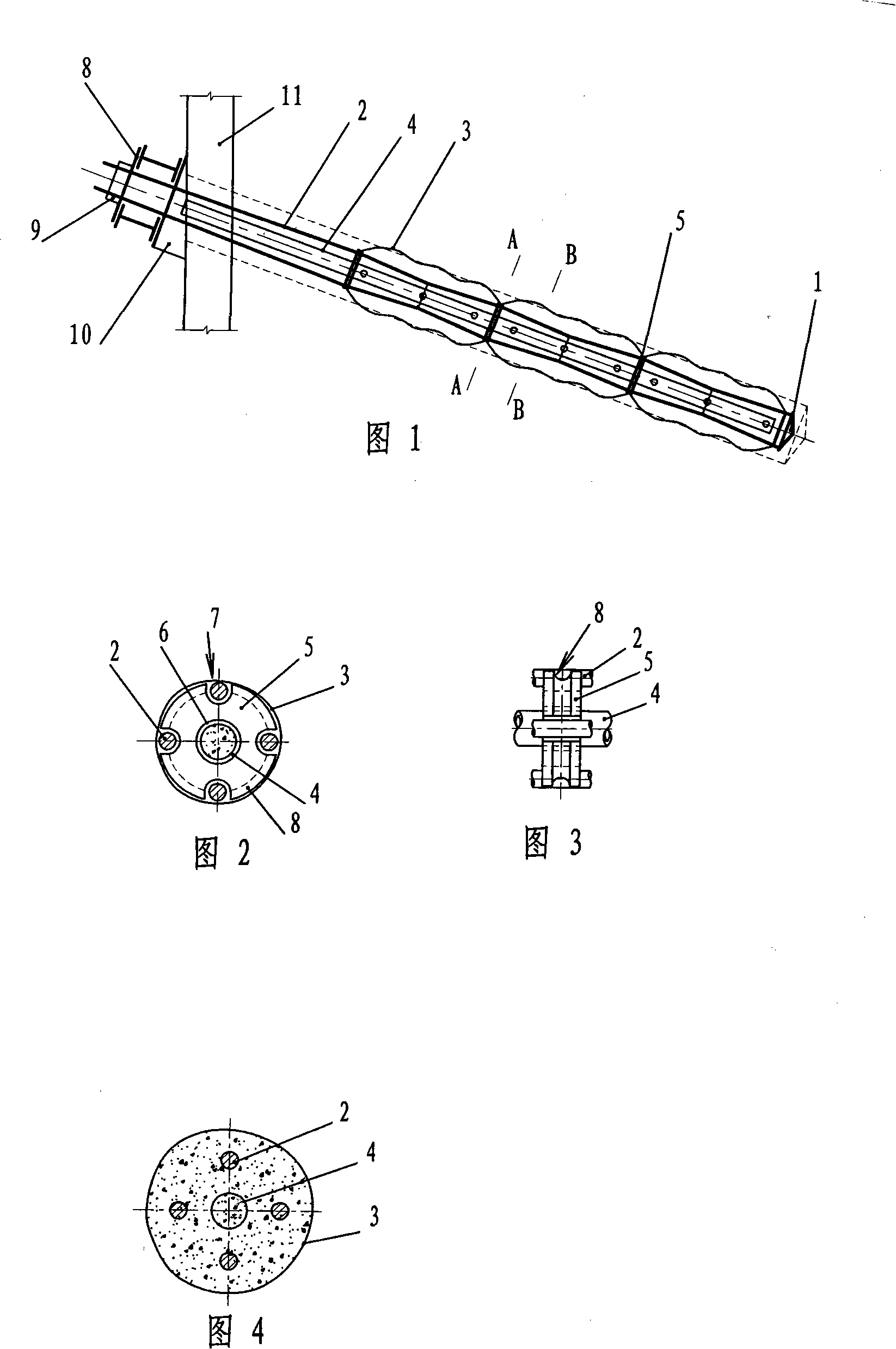 Multistage bag-type compression anchor bar