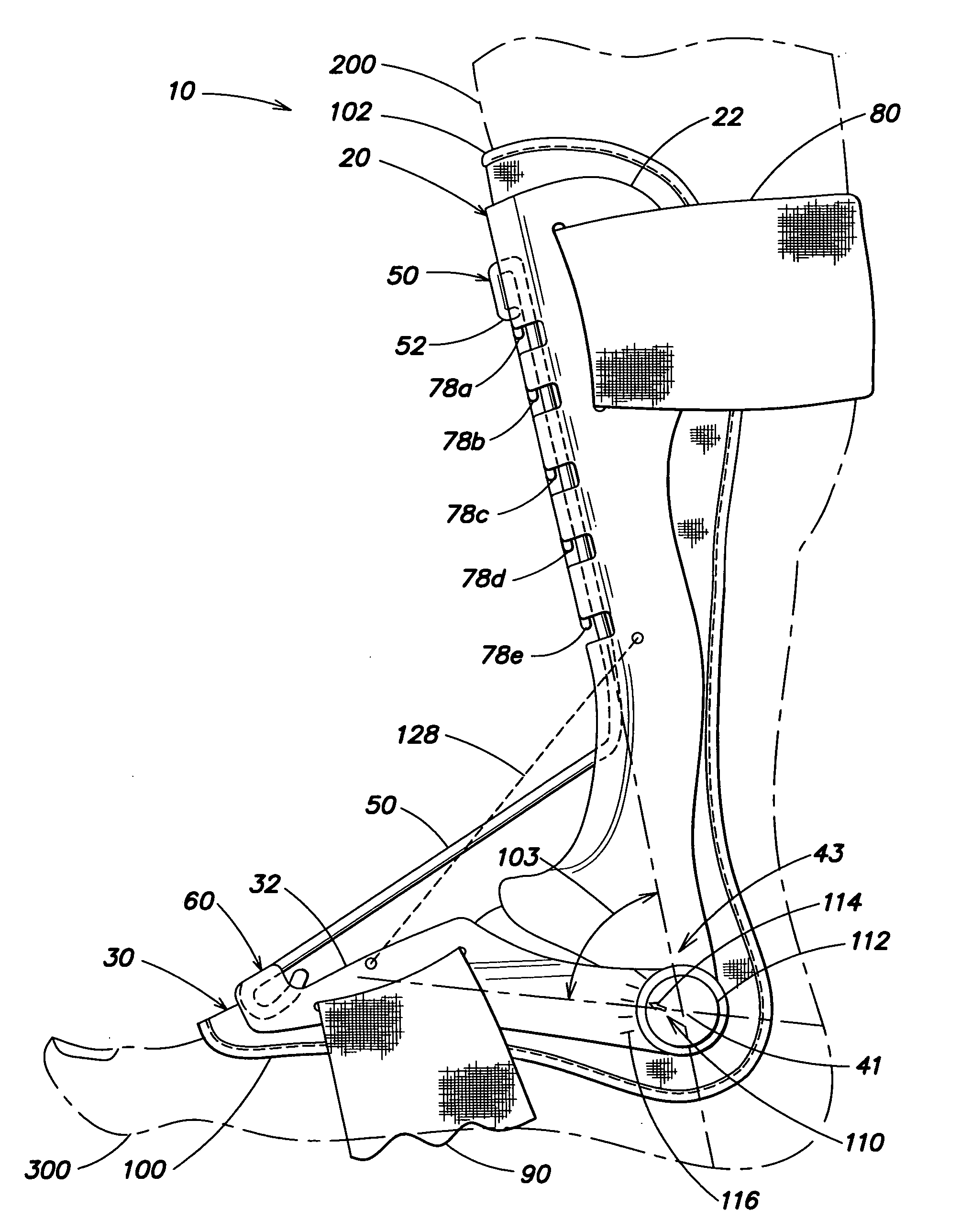 Flexibly adjustable dorsal splint