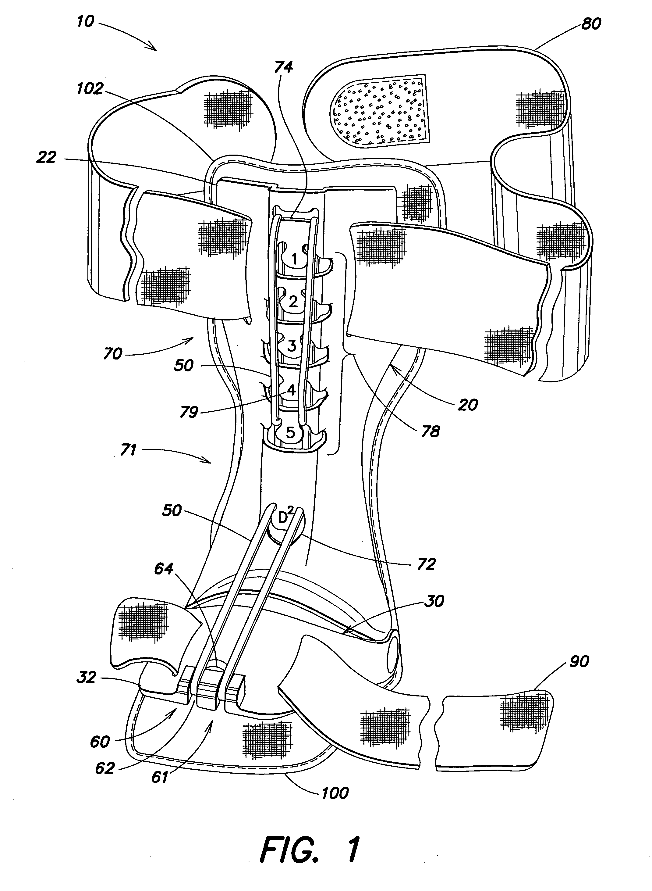 Flexibly adjustable dorsal splint