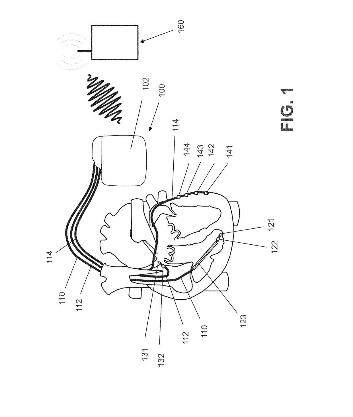 Apparatus and Method to Optimize Pacing Parameters