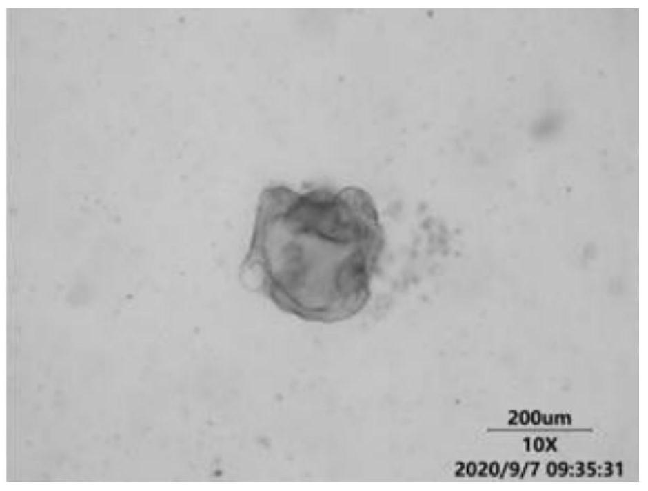 A kind of culture solution for colorectal cancer organoid culture and preparation method thereof