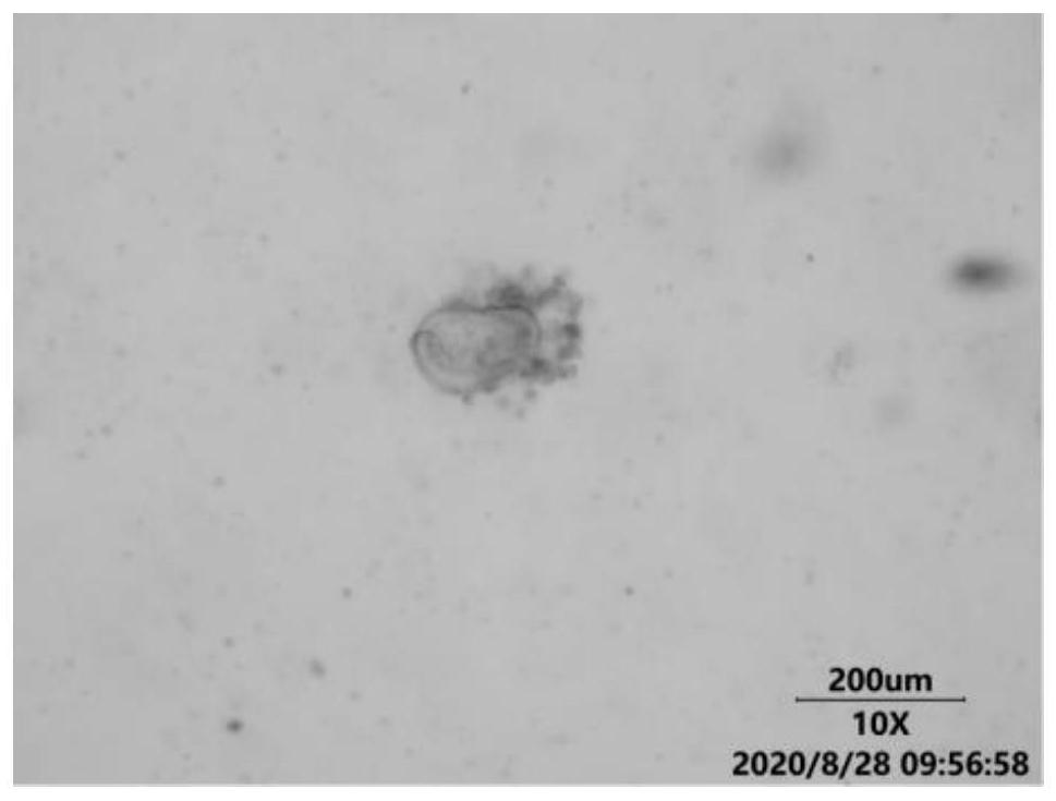 A kind of culture solution for colorectal cancer organoid culture and preparation method thereof