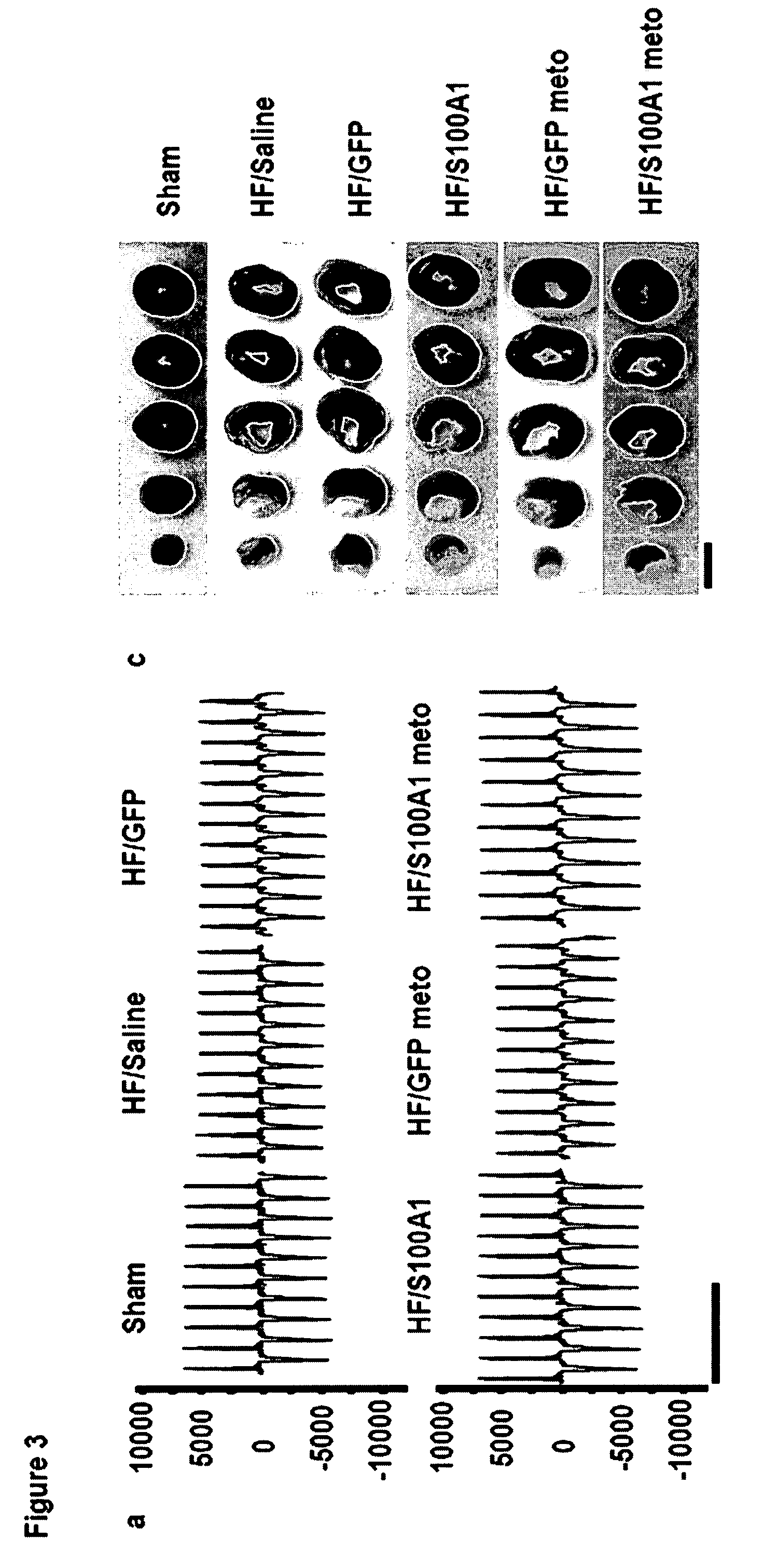 Tissue specific gene therapy treatment