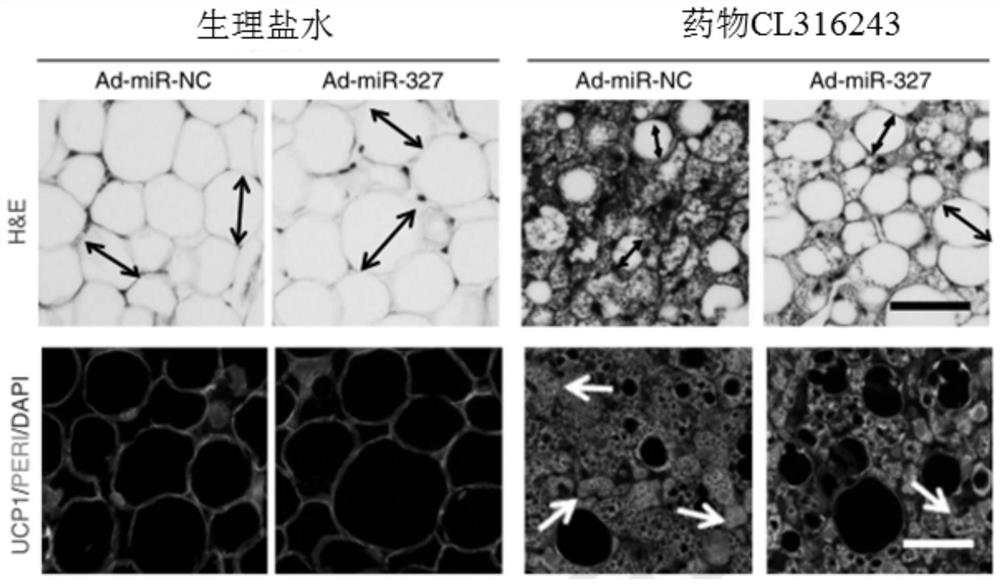 Use of miR-327 inhibitors and/or FGF10 promoters in drugs for the prevention and/or treatment of lipodystrophy