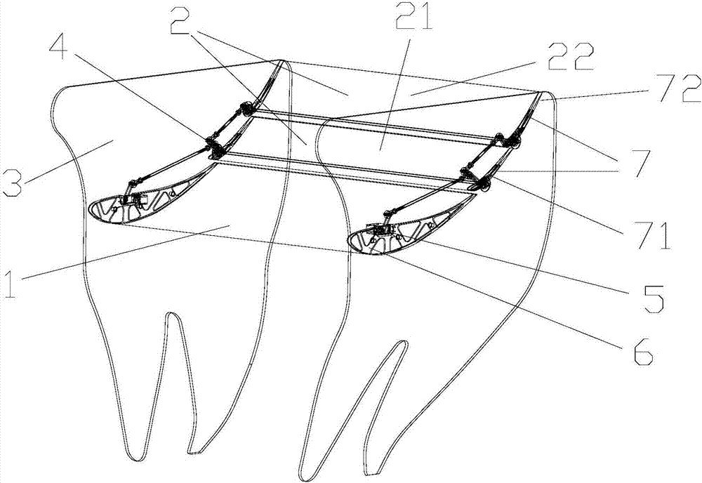 Adjustable spoiler system of formula car