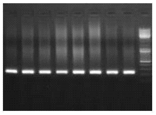 Combined application and method for detecting GRK4 mutant, systolic pressure variation and urine sodium excretion rate