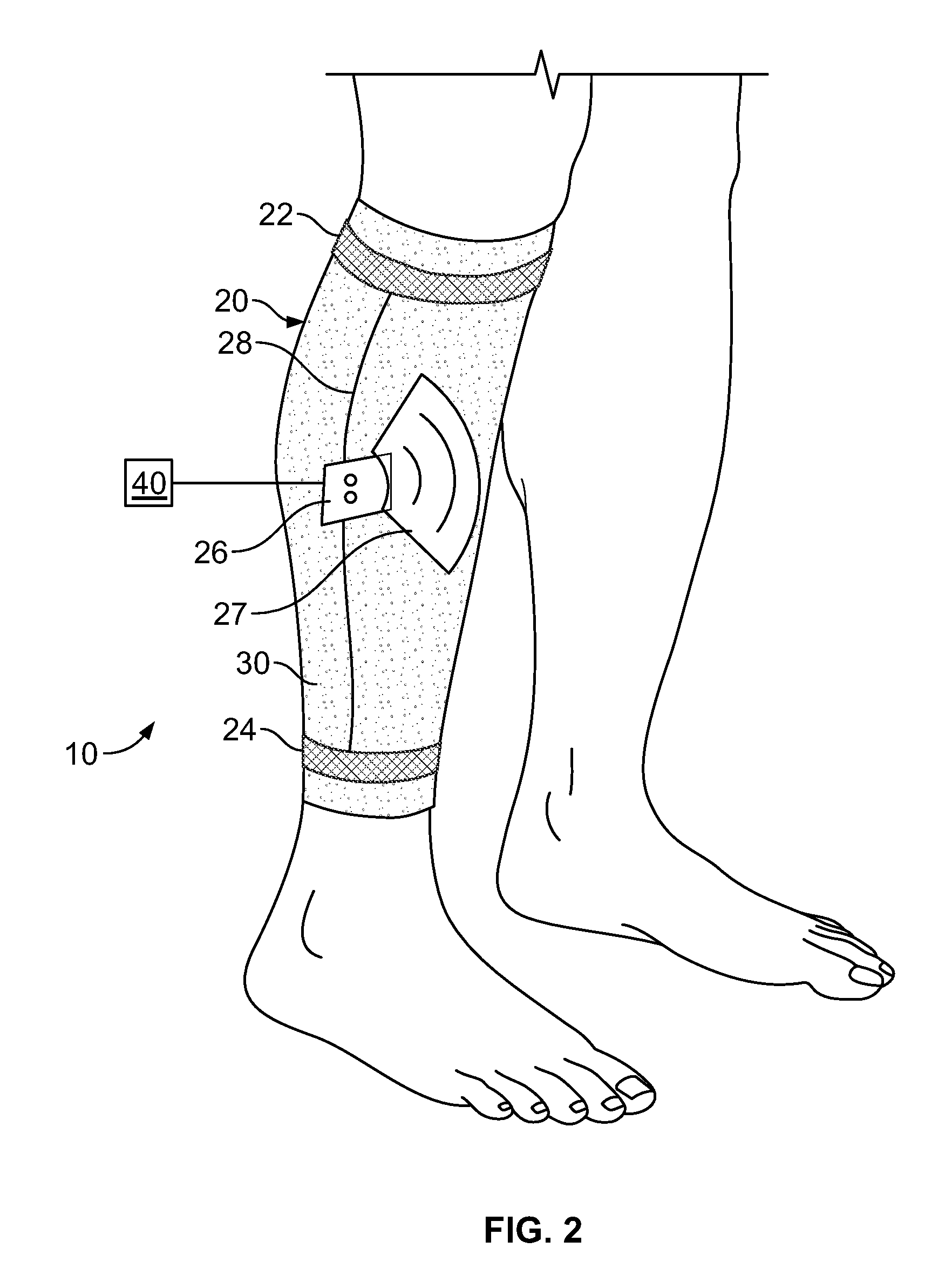 System for using electrical muscle stimulation to increase blood flow in body parts