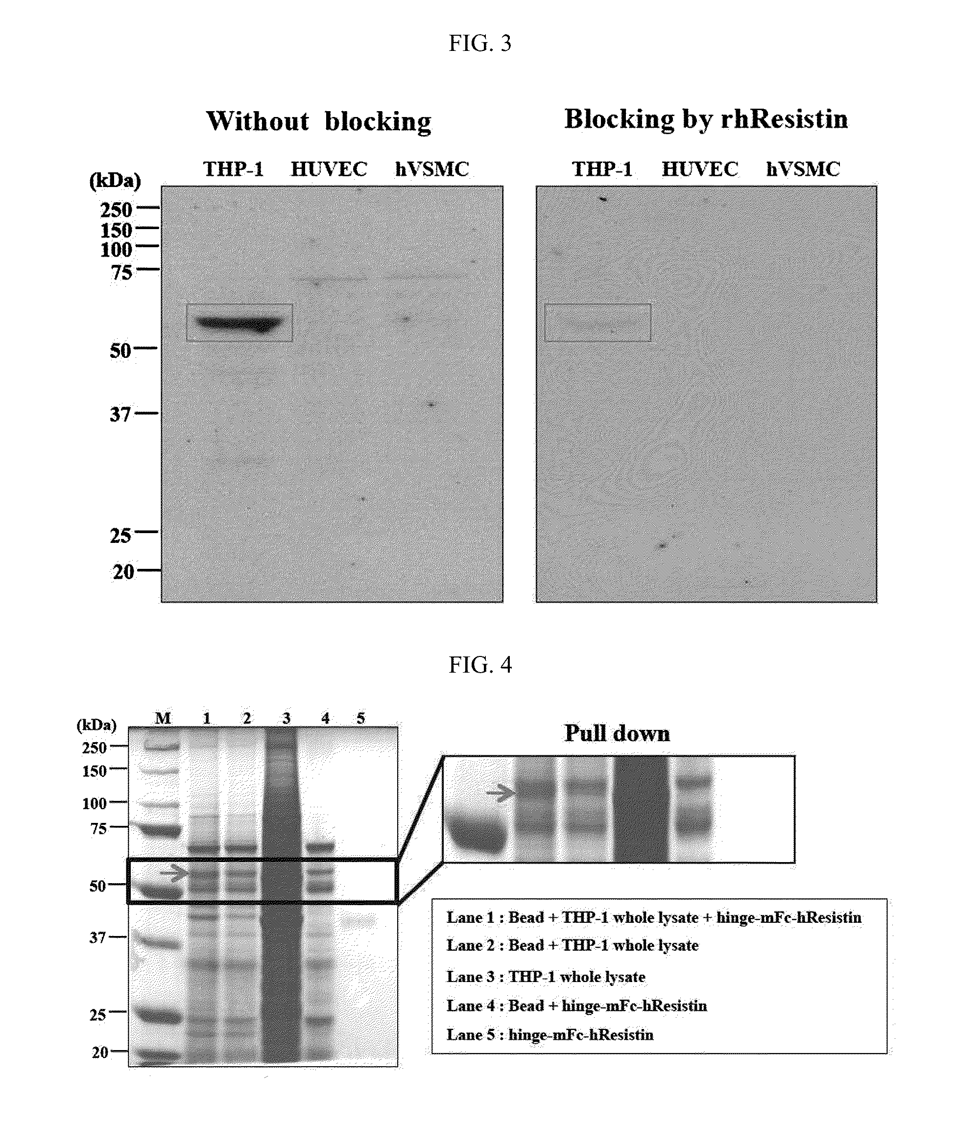 Human resistin receptor and use thereof