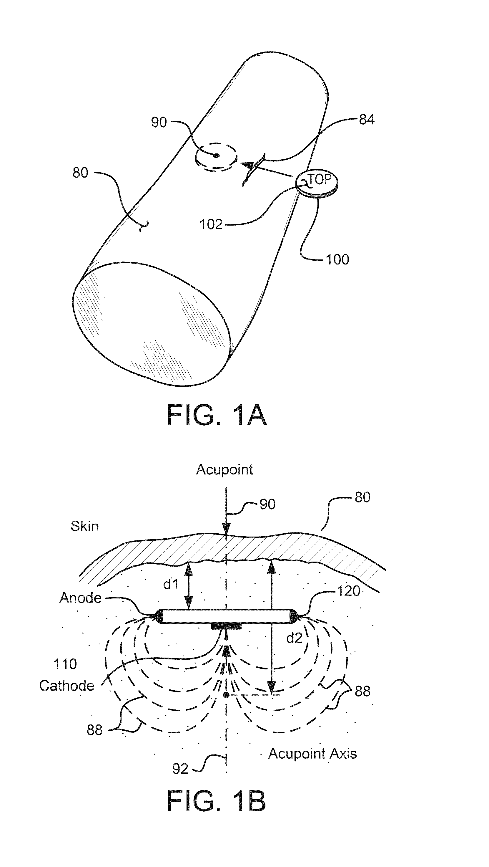 Methods and Systems for Treating Cardiovascular Disease Using an Implantable Electroacupuncture Device