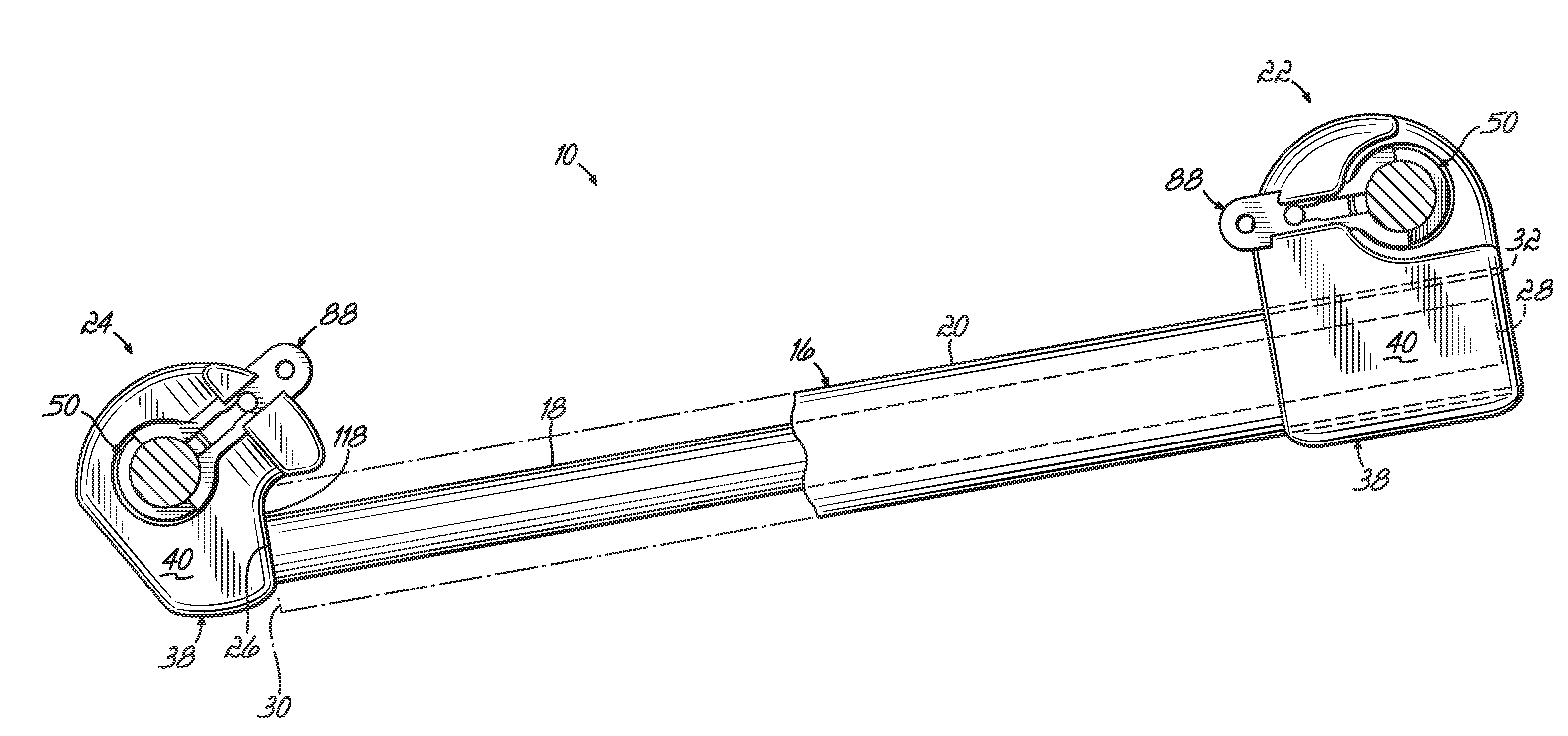 Orthodontic device and method for treating malocclusions