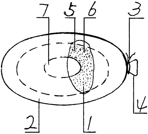 Methods for making and using three-component weight-reducing pill