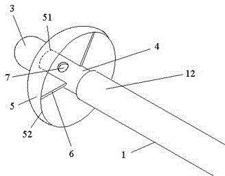 Membrane type ureteral calculus blocking extractor