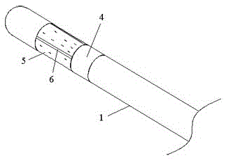 Membrane type ureteral calculus blocking extractor