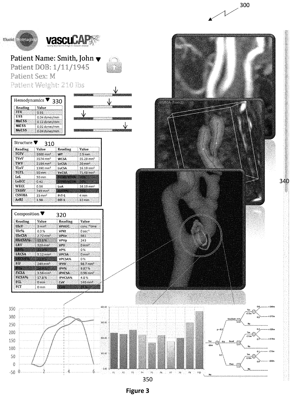 Quantitative imaging for detecting vulnerable plaque