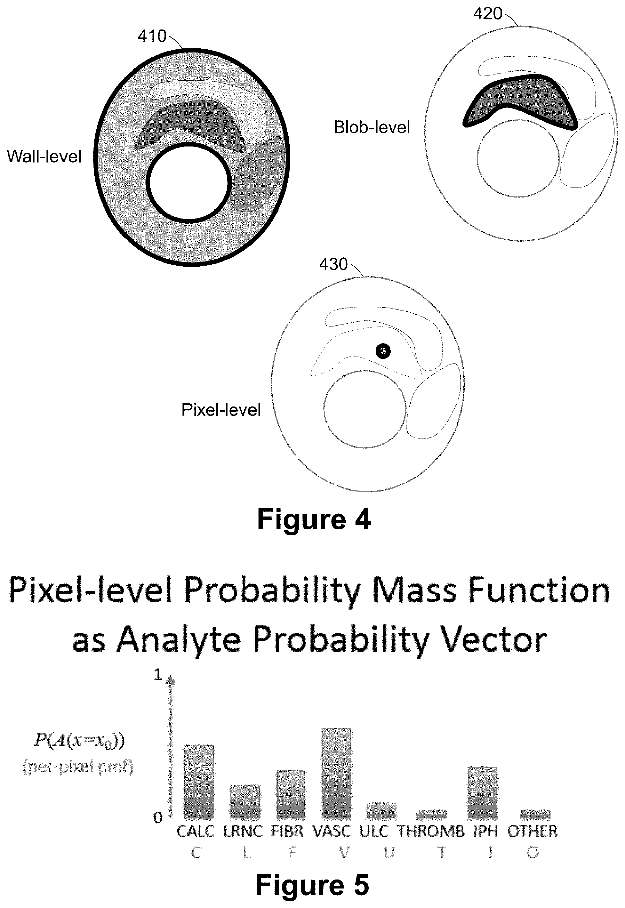 Quantitative imaging for detecting vulnerable plaque