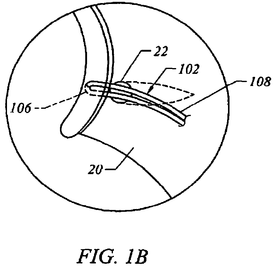 Method and apparatus for attaching connective tissues to bone using a knotless suture anchoring device