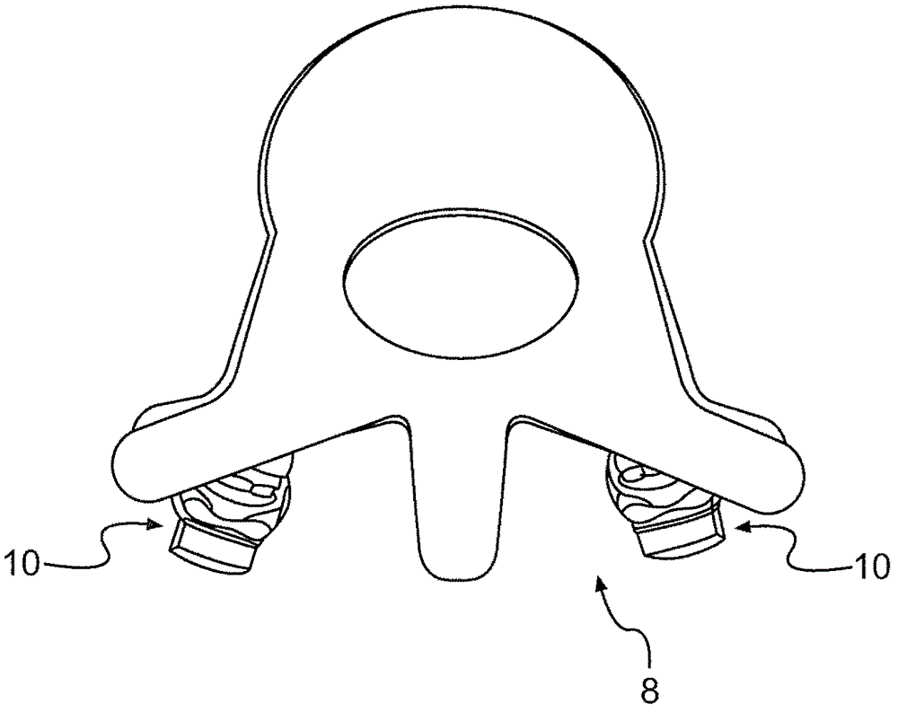 Posterior functionally dynamic stabilization system