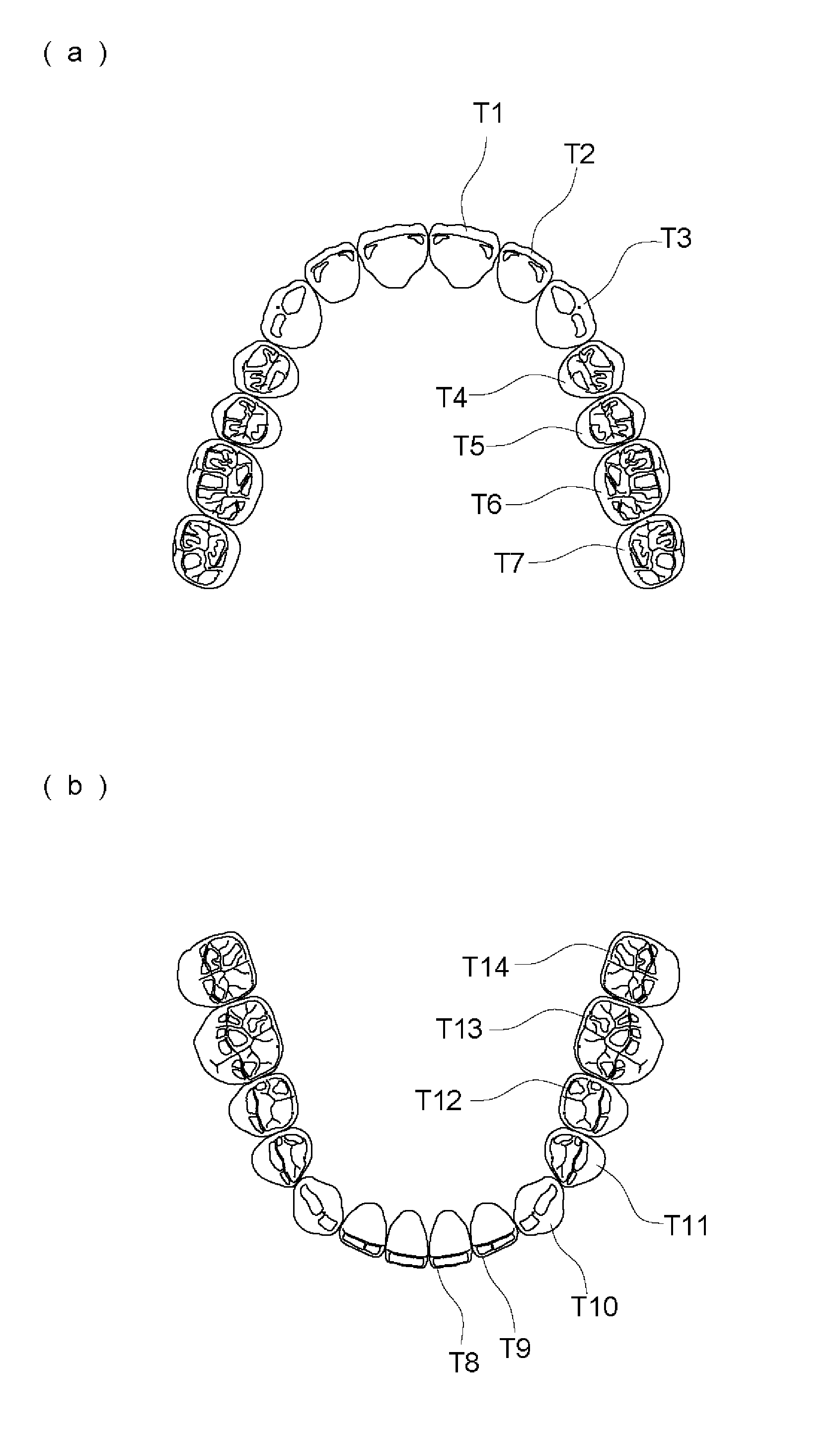 Artificial teeth easily enabling bilateral balanced occlusion