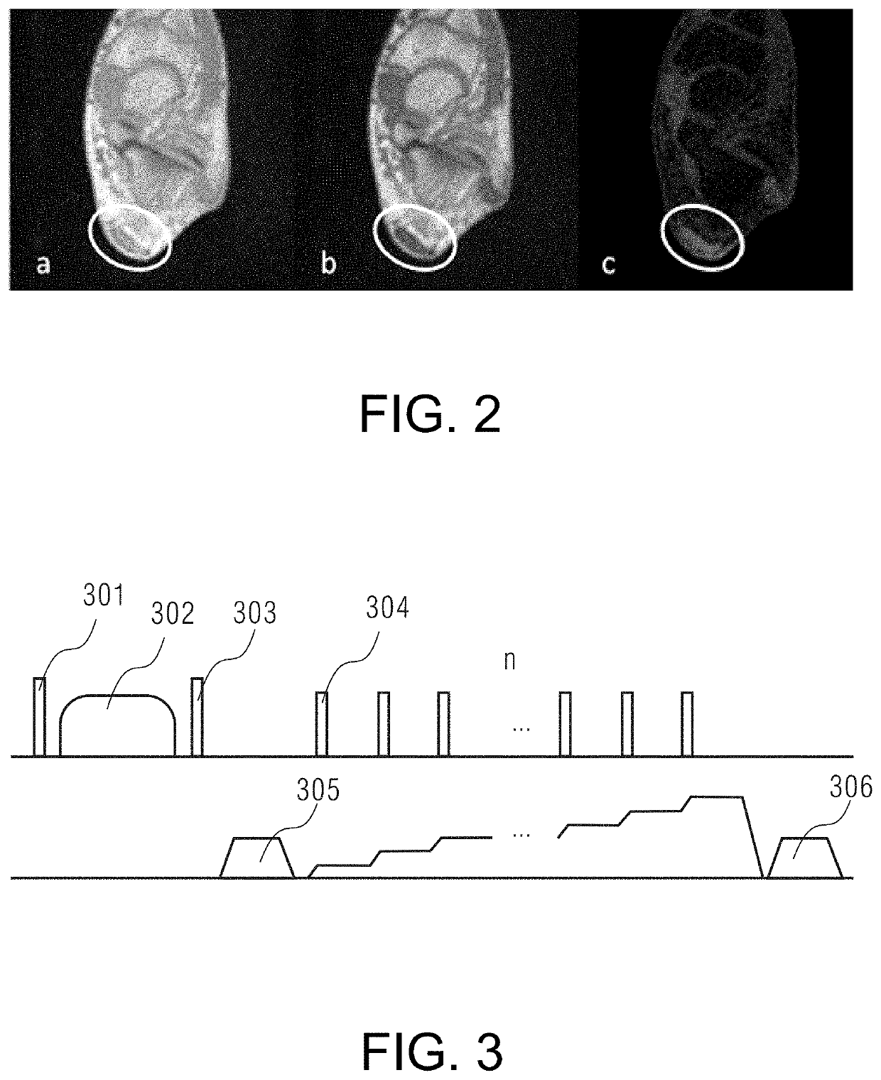 Short t2 tissue imaging with t2 prep petra sequence