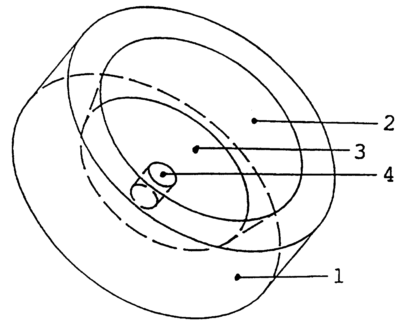 Device for mounting a component exposed to a pressurized fluid