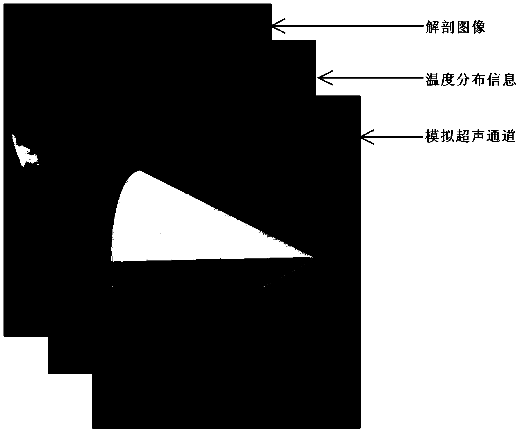 Focused-ultrasound treatment device and method