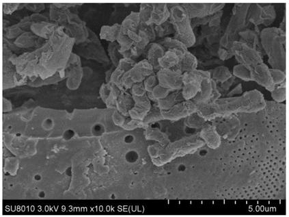 Recombinant escherichia coli immobilized cell and application to production of xylitol from xylose mother liquor