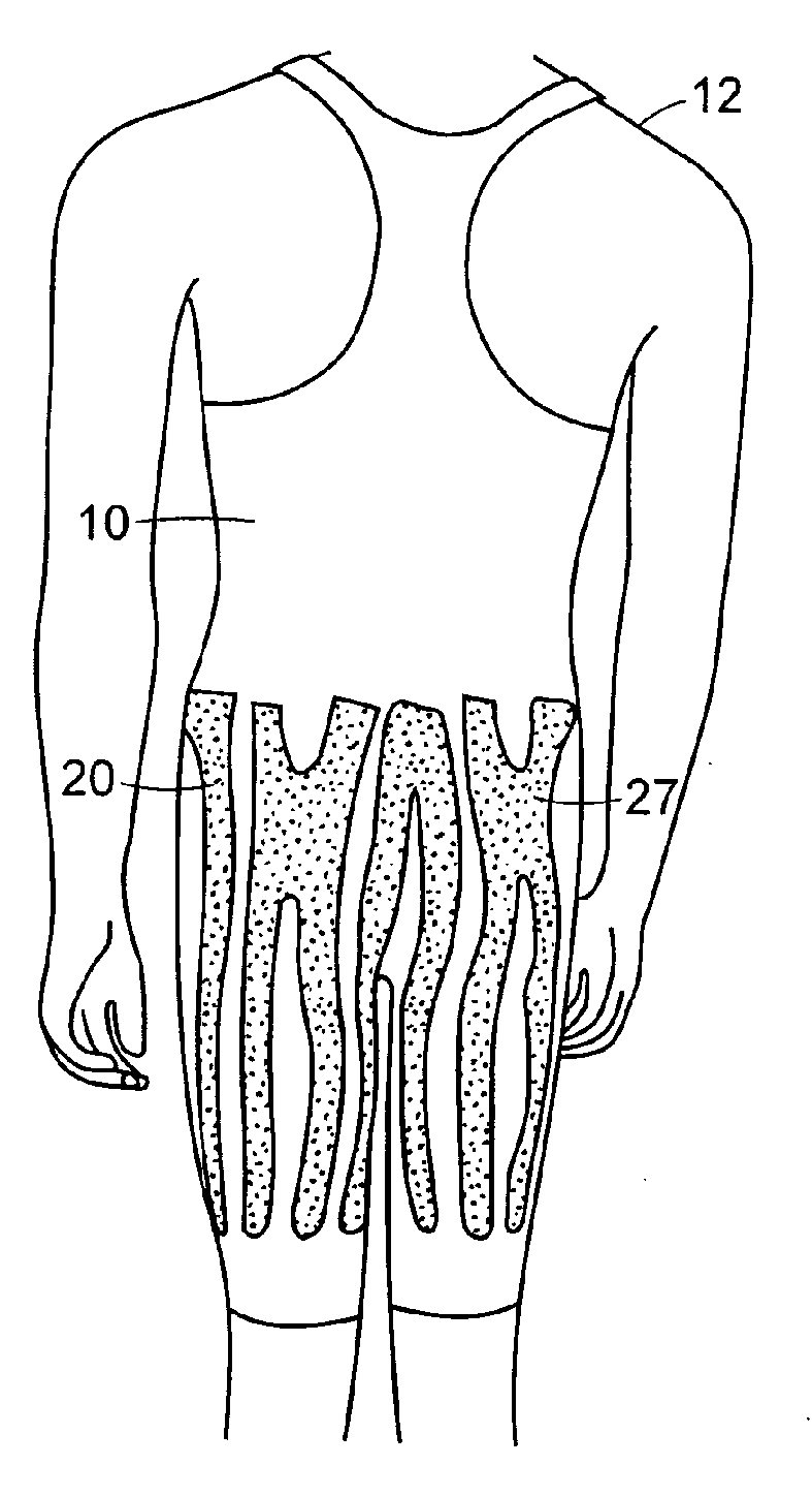 Garment