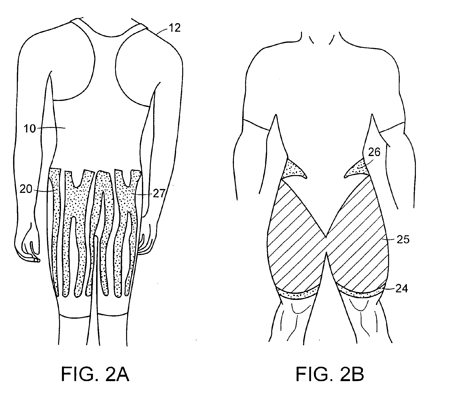 Garment