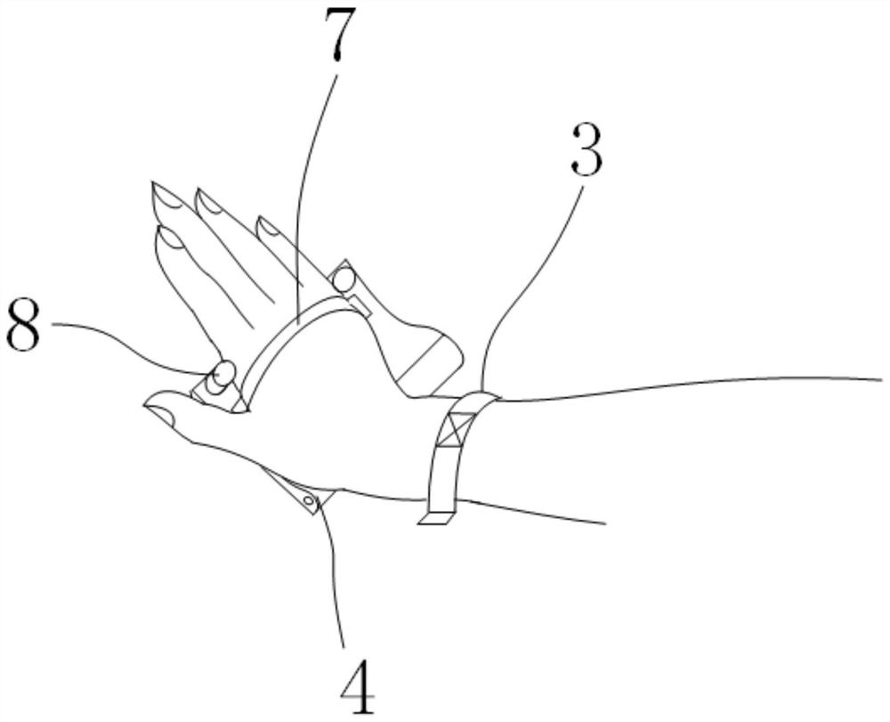 Integrated gypsum fixing equipment with auxiliary fracture reduction function