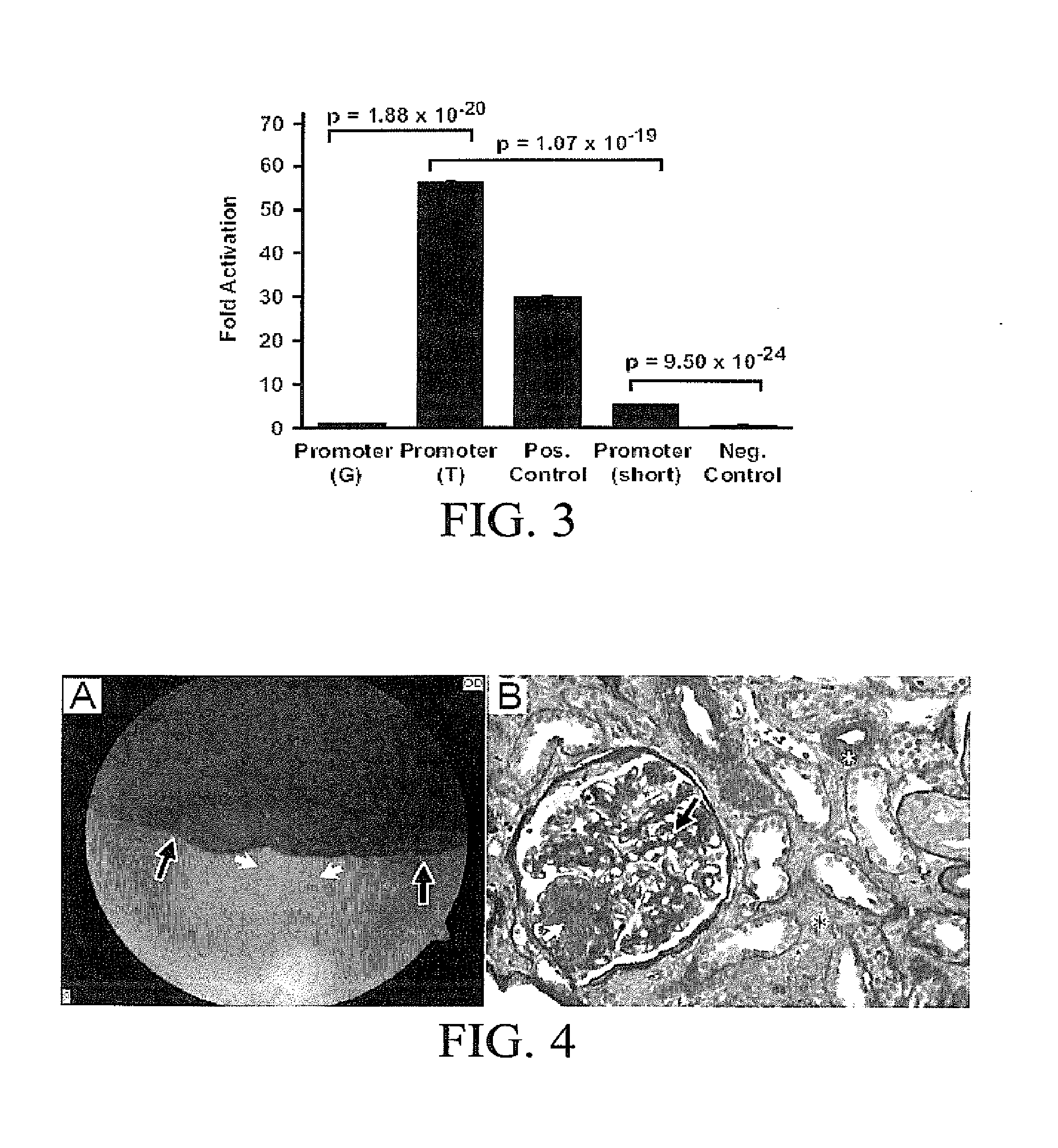 Compositions and Methods for Diagnosing and Treating Diabetic Micro Vascular Complications