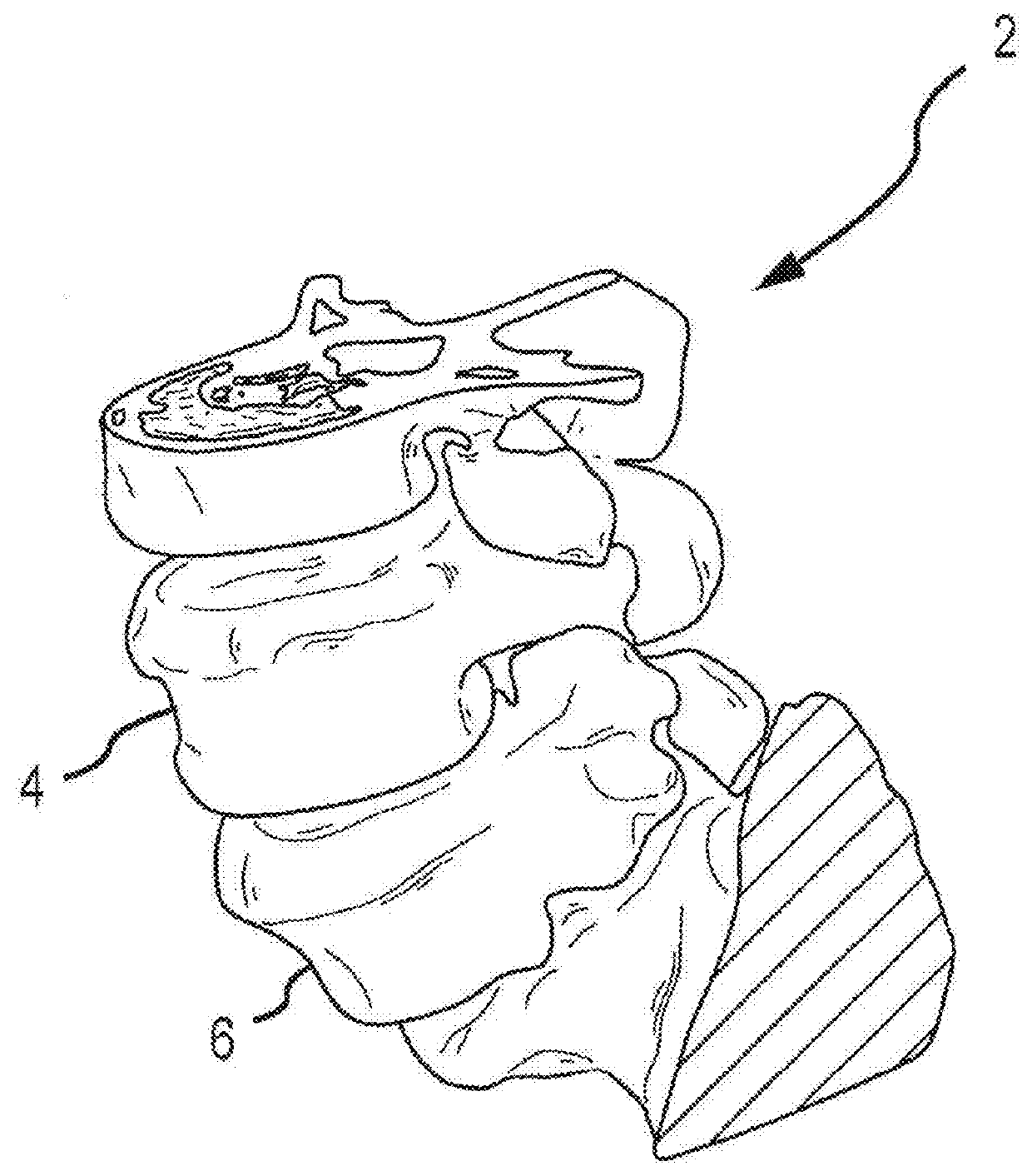 Patient-Matched Apparatus and Methods for Performing Surgical Procedures