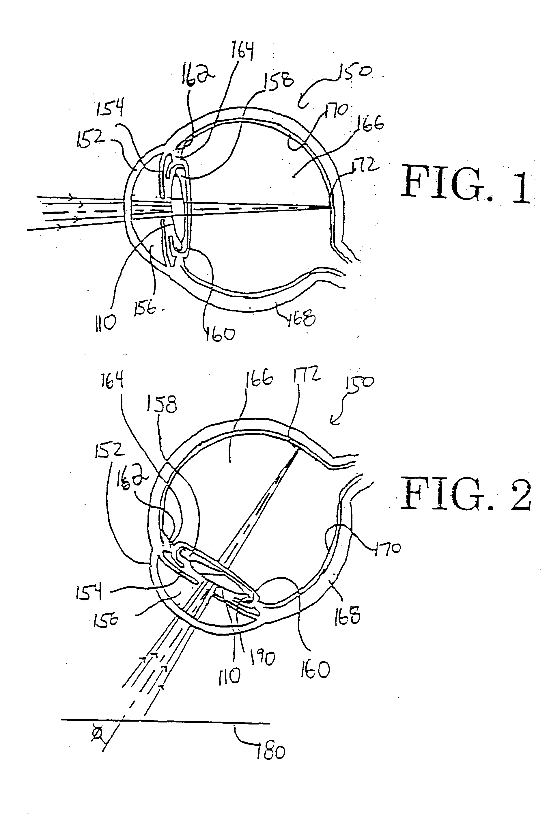 Multi-focal intraocular lens, and methods for making and using same