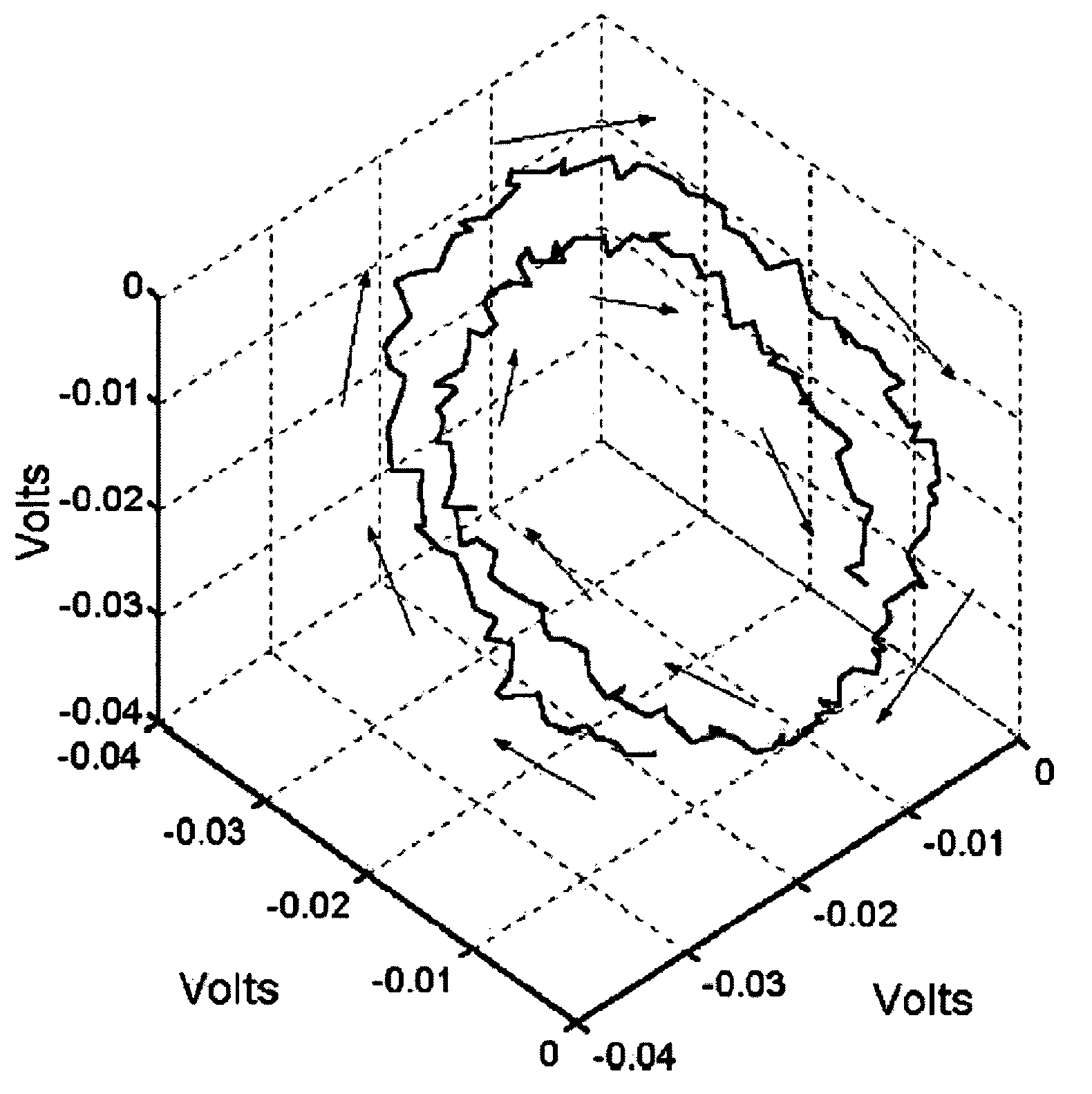 Devices, systems and methods for characterization of ventricular fibrillation and for treatment of ventricular fibrillation