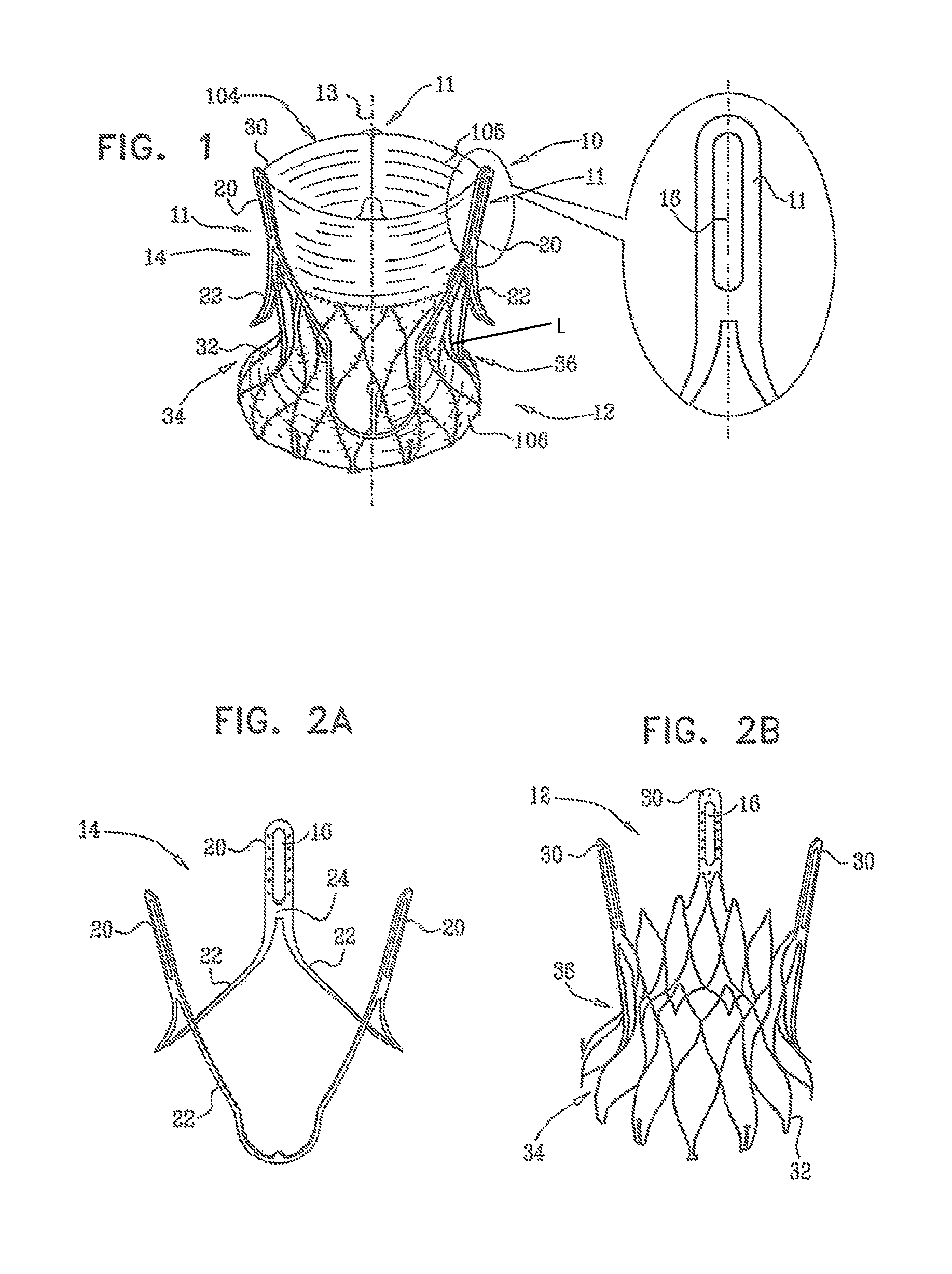 Prosthetic heart valve having identifiers for aiding in radiographic positioning