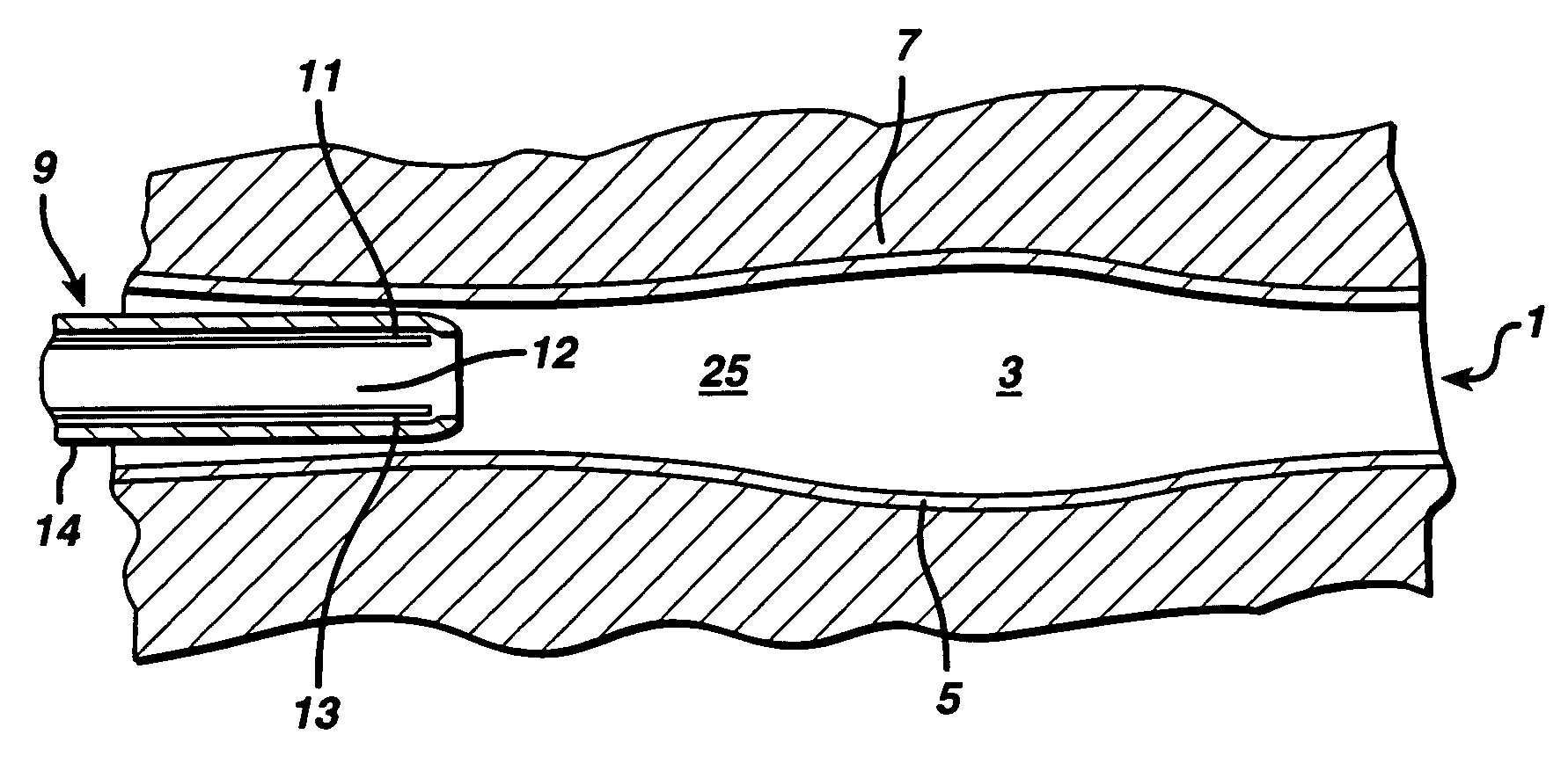 Swollen hydrogel for sphincter augmentation