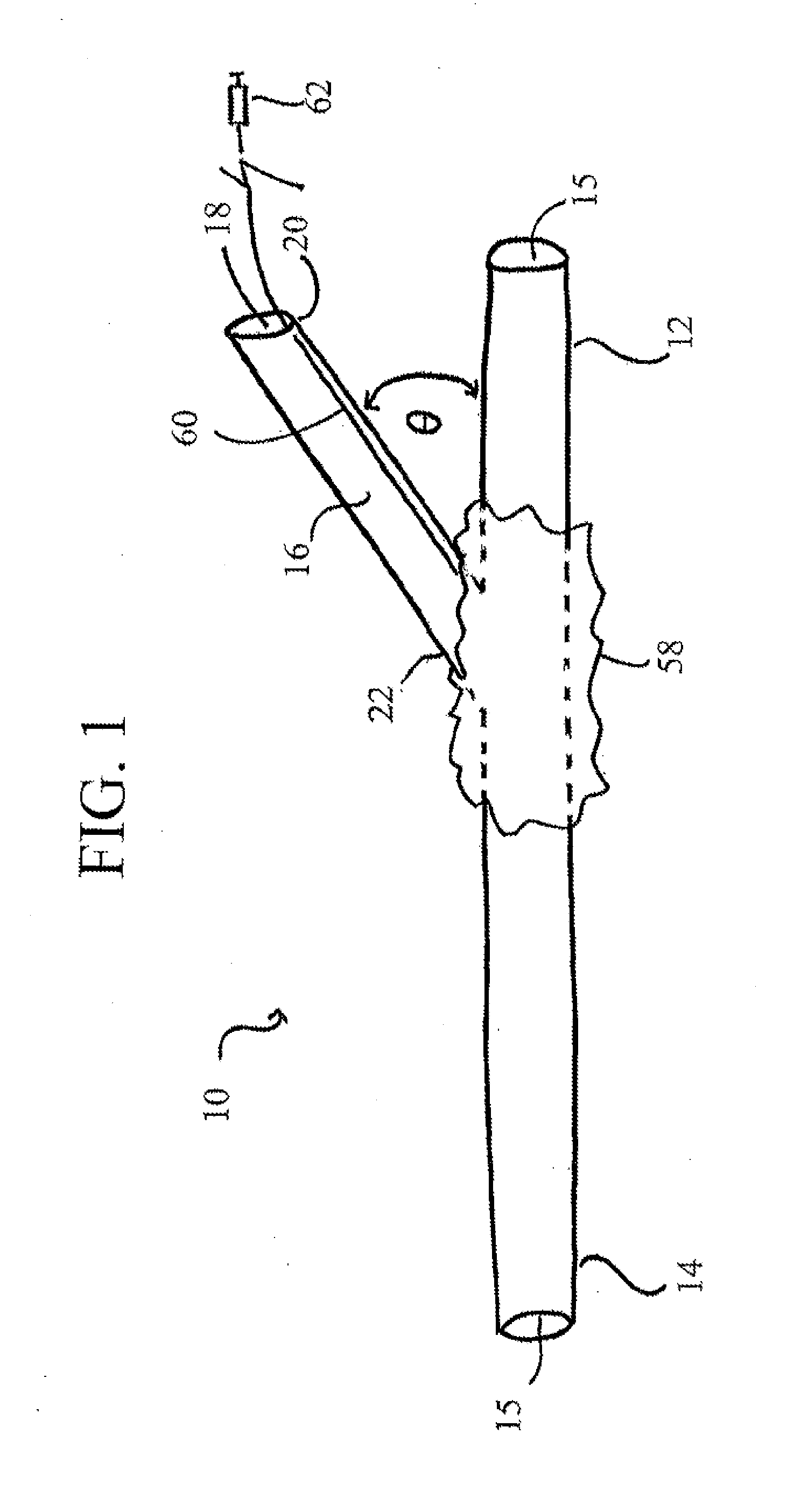 Systems, devices, and methods for organ retroperfusion along with regional mild hypothermia