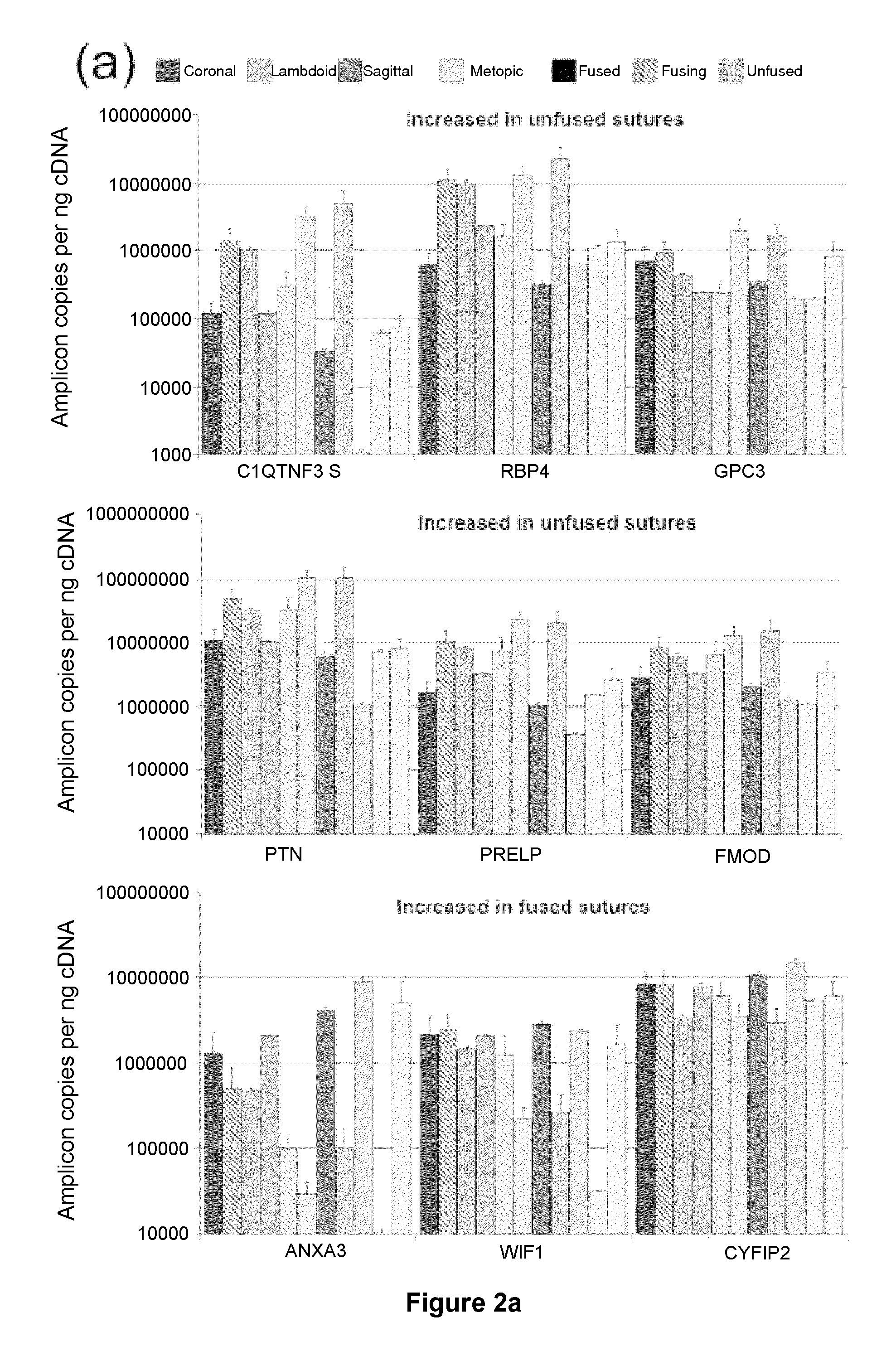 Method of treatment, prophylaxis and diagnosis of pathologies of the bone