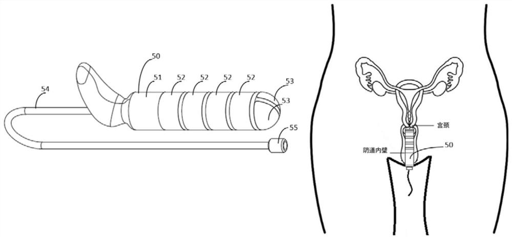 Device and system for treating infertility and methods for regulating body fluids and regulating nerves and meridians