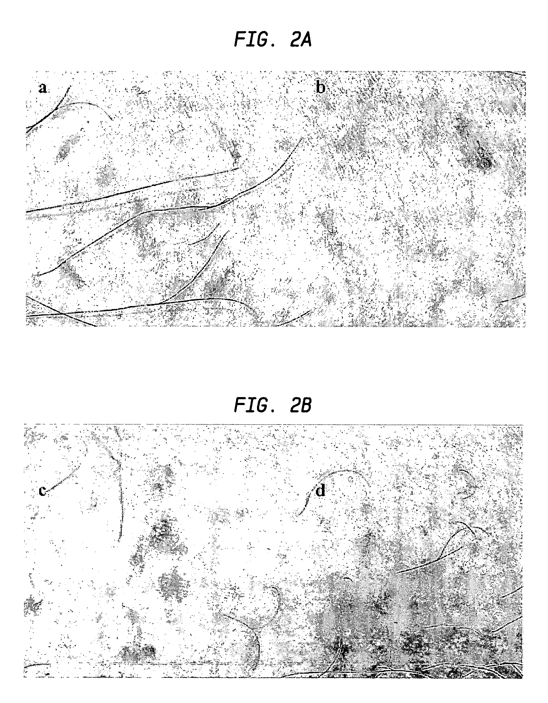 Methods and devices for epithelial protection during photodynamic therapy